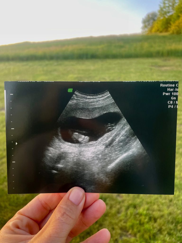 surprise!